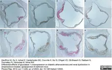 Anti Rat IgG (Mouse Adsorbed) Ab - HRP gallery image 3