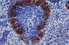 Anti Rat IgG (Mouse Adsorbed) Ab - HRP gallery image 6