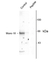 Anti MUNC-18 (pSer515) Antibody thumbnail image 1