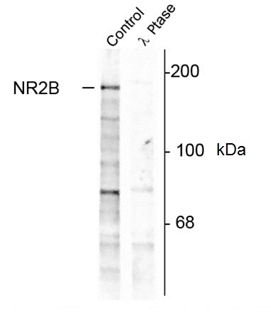 Anti NMDA Receptor NR2B (pTyr1252) Antibody gallery image 1