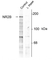 Anti NMDA Receptor NR2B (pTyr1252) Antibody thumbnail image 1