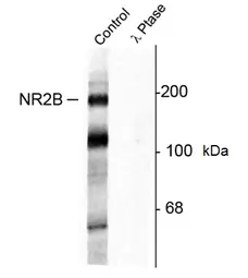 Anti NMDA Receptor NR2B (pTyr1472) Antibody gallery image 1