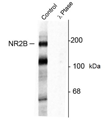 Anti NMDA Receptor NR2B (pTyr1472) Antibody gallery image 1