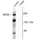 Anti NMDA Receptor NR2B (pTyr1472) Antibody thumbnail image 1