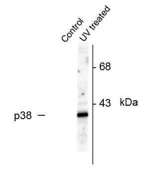 Anti p38 MAPK (pThr180/pTyr182) Antibody (Polyclonal Antibody Antibody) gallery image 2