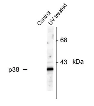 Anti p38 MAPK (pThr180/pTyr182) Antibody (Polyclonal Antibody Antibody) gallery image 2