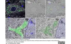 Anti Rat TGN38 Antibody gallery image 5