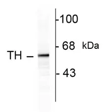 Anti Tyrosine Hydroxylase Antibody gallery image 1