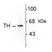 Anti Tyrosine Hydroxylase Antibody thumbnail image 1