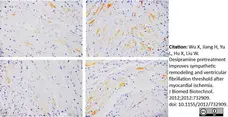 Anti Tyrosine Hydroxylase Antibody gallery image 2