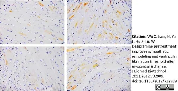 Anti Tyrosine Hydroxylase Antibody gallery image 2
