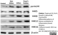 Anti Histone H4 (Ac12) Antibody gallery image 2