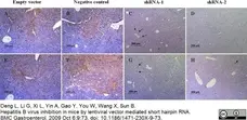 Anti Hepatitis B Surface Antigen Antibody gallery image 2