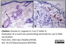 Anti Hepatitis B Surface Antigen Antibody gallery image 3