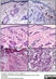 Anti Hepatitis B Surface Antigen Antibody thumbnail image 3