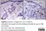 Anti Hepatitis B Surface Antigen Antibody thumbnail image 3