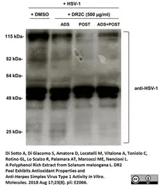 Goat Anti Herpes simplex Virus 1/2 Antibody  gallery image 2