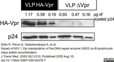 Anti Human Immunodeficiency Virus 1 p24 Antibody gallery image 1