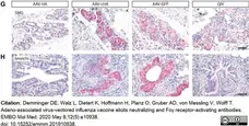 Anti Influenza A H1N1 Antibody gallery image 1