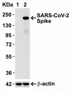 Anti SARS-CoV-2 Spike Protein Antibody gallery image 1