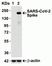 Anti SARS-CoV-2 Spike Protein Antibody thumbnail image 1