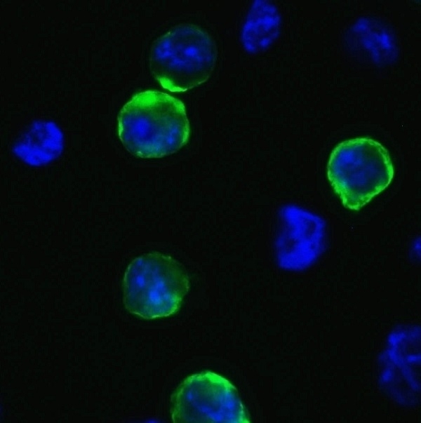 Anti SARS-CoV-2 Spike Protein Antibody gallery image 2