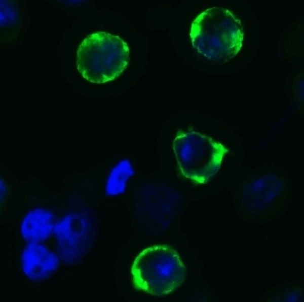 Anti SARS-CoV-2 Spike Protein Cleavage Site Antibody gallery image 1