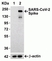 Anti SARS-CoV-2 Spike Protein Cleavage Site Antibody thumbnail image 2