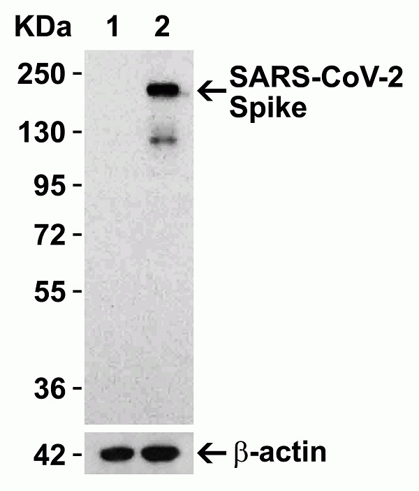 Anti SARS-CoV-2 Spike Protein Cleavage Site Antibody gallery image 2