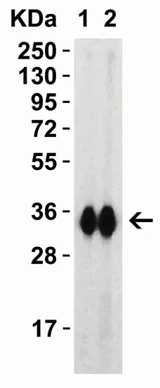 Anti SARS-CoV-2 Spike Protein Rbd Antibody gallery image 1