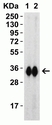 Anti SARS-CoV-2 Spike Protein Rbd Antibody thumbnail image 1