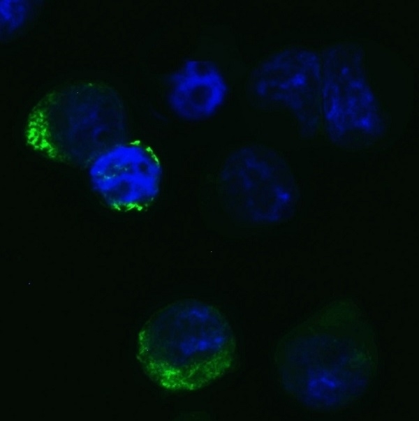Anti SARS-CoV-2 Spike Protein Rbd Antibody gallery image 2