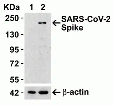 Anti SARS-CoV-2 Spike Protein Rbd Antibody gallery image 3