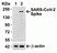 Anti SARS-CoV-2 Spike Protein Rbd Antibody thumbnail image 3