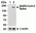 Anti SARS-CoV-2 Spike Protein Rbd Antibody thumbnail image 3