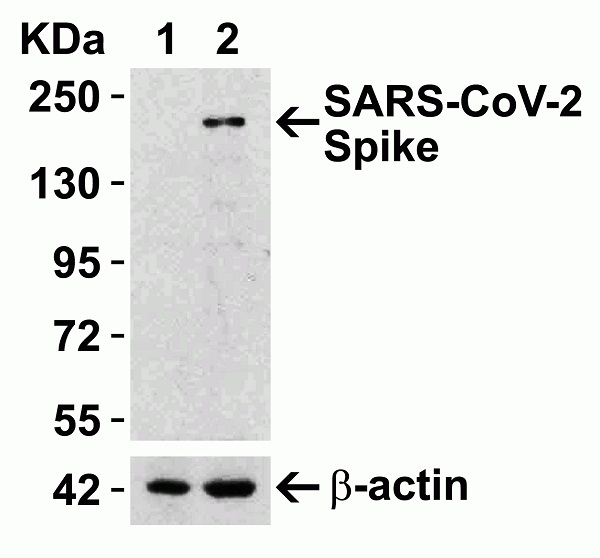 Anti SARS-CoV-2 Spike Protein Rbd Antibody gallery image 3