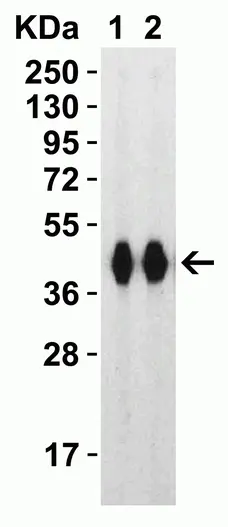 Anti SARS-CoV-2 Spike Protein Rbd Antibody gallery image 4