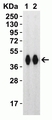 Anti SARS-CoV-2 Spike Protein Rbd Antibody thumbnail image 4