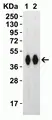 Anti SARS-CoV-2 Spike Protein Rbd Antibody thumbnail image 4