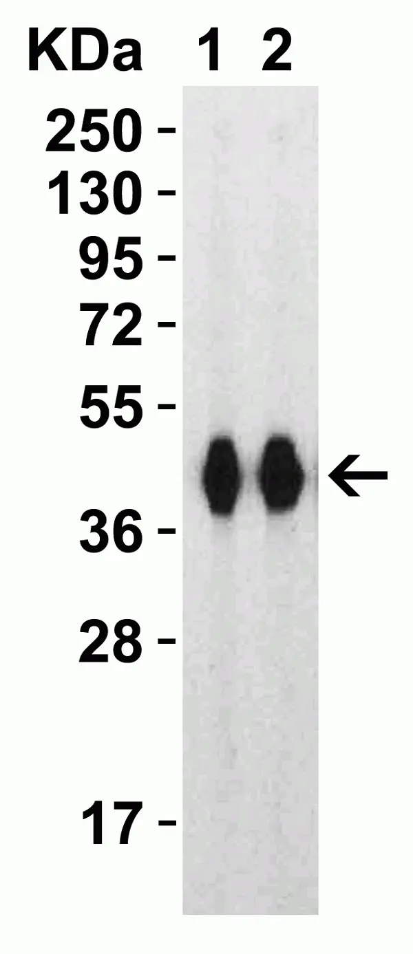Anti SARS-CoV-2 Spike Protein Rbd Antibody gallery image 4