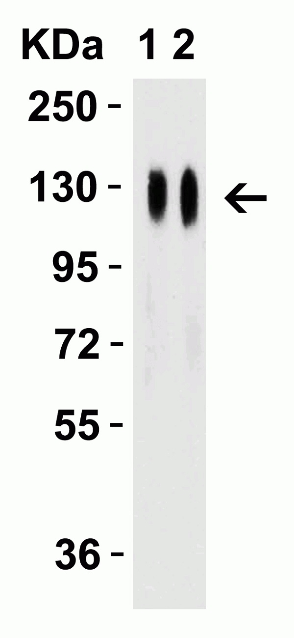 Anti SARS-CoV-2 Spike Protein Rbd Antibody gallery image 7