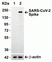 Anti SARS-CoV-2 Spike Protein S1 Antibody thumbnail image 1