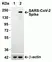 Anti SARS-CoV-2 Spike Protein S1 Antibody thumbnail image 1