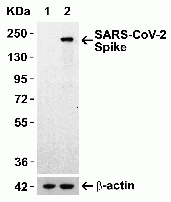 Anti SARS-CoV-2 Spike Protein S1 Antibody gallery image 1