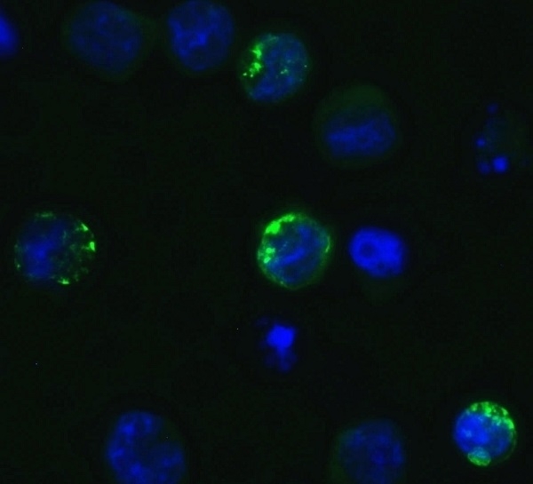 Anti SARS-CoV-2 Spike Protein S1 Antibody gallery image 2