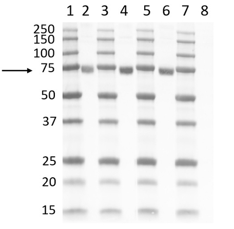 positive spike protein antibody test