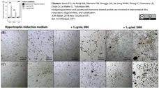 Recombinant Human FGF Basic gallery image 1