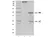 Recombinant Human IgG1 Kappa Allotype G1m3, clone AbD18705_hIgG1 thumbnail image 1