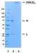 Recombinant Human IgM Kappa, clone AbD18705_hIgM thumbnail image 1
