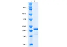 Recombinant Human Interleukin-11 gallery image 2